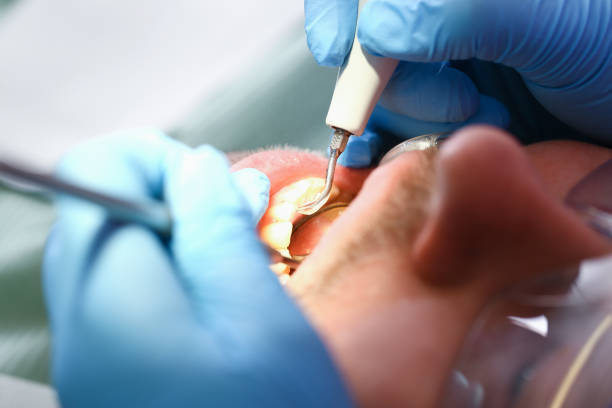 Best Emergency Cosmetic Dentistry (e.g., broken veneers) in Dash Point, WA