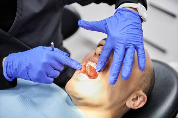 Best Emergency Care for Gum Disease in Dash Point, WA