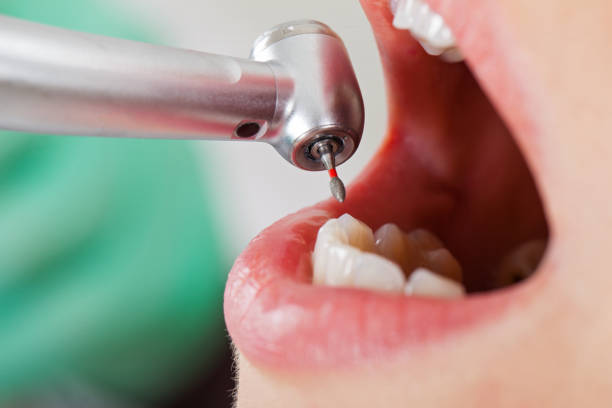 Best Walk-In Emergency Dental Services in Dash Point, WA